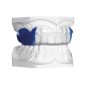 Bioplast xtreme Pro Kit protège-dent avec renfort intégré - SCHEU Bioplast xtreme Pro Kit protège-dent avec renfort intégré - SCHEU