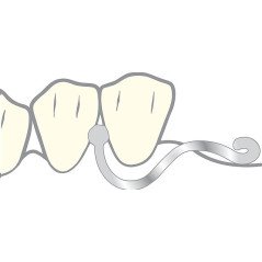 Ancre anker - SCHEU DENTAL