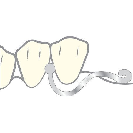 Ancre anker - SCHEU DENTAL