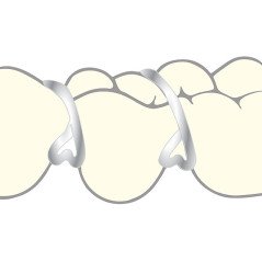 Crochet triangulaire 100 pcs pack économique - SCHEU