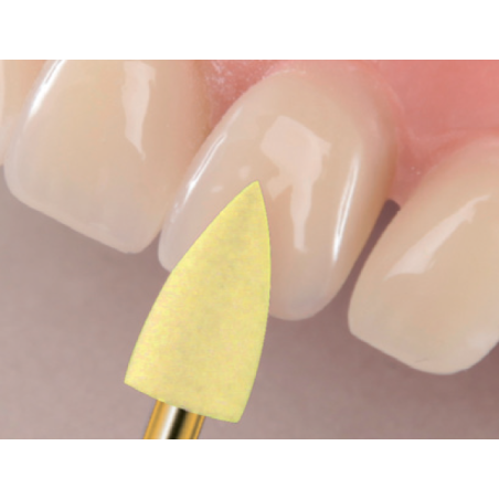 Polissoirs TopGloss Ra brillant supérieur - EDENTA