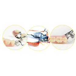 Opaquer métal  rose Sebond Bond, seringue de 5 g - SCHUTZ DENTAL