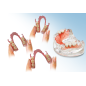 Matériau nylon flexible pour prothèses 250g Dentiflex - ROKO Matériau nylon flexible pour prothèses 250g Dentiflex - ROKO
