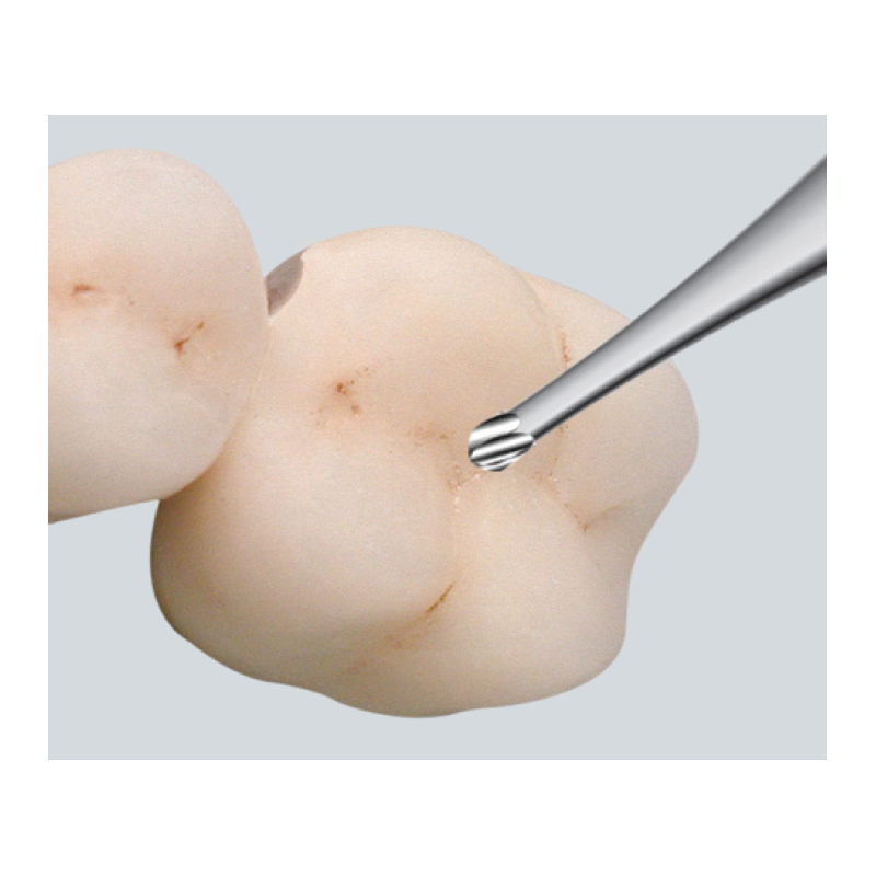 Fraise en boule pour des fissures C1 taille de précision - EDENTA Fraise en boule pour des fissures C1 taille de précision - EDENTA