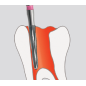 Fraise endodontique FGL 5pcs - EDENTA Fraise endodontique FGL 5pcs - EDENTA