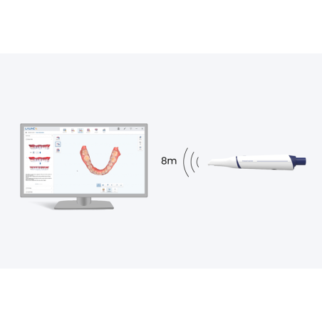 Scanner intraoral sans fil - solution idgitale pour cabinet dentaire - LAUNCA
