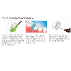 Clearfil Ceramic Primer Plus - KURARAY NORITAKE