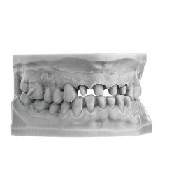 copie de copie de copie de copie de Imprimante 3d dentaire ASIGA MAX2 - SCHEU DENTAL