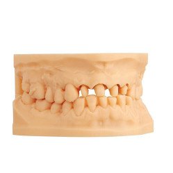copie de copie de copie de copie de Imprimante 3d dentaire ASIGA MAX2 - SCHEU DENTAL