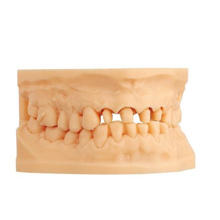 Résine 3d Modèle IMPRIMO ® LC 1L - SCHEU DENTAL