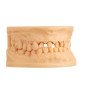 Résine 3d Modèle IMPRIMO ® LC 1L - SCHEU DENTAL Résine 3d Modèle IMPRIMO ® LC 1L - SCHEU DENTAL