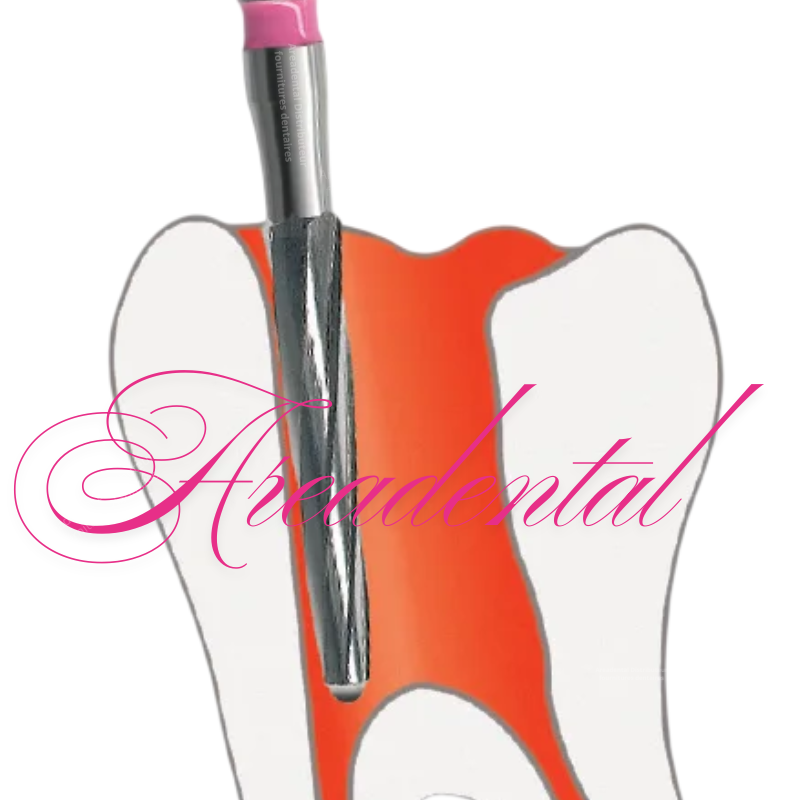 Fraise endodontique FGL 5pcs - EDENTA