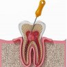 Endodontie