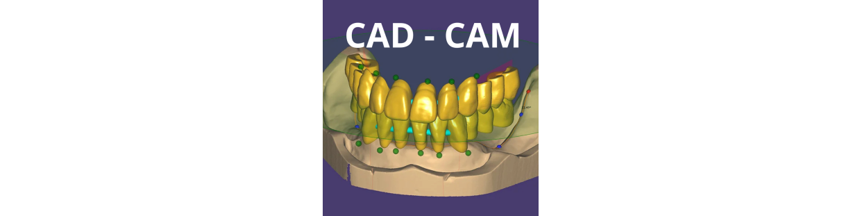 CAD/CAM Prothésiste Dentaire – Matériel & Solutions Numériques