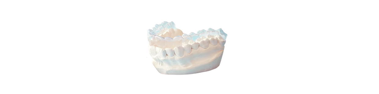 Plâtre spécial orthodontie – Modèles précis et haute résistance