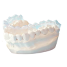 Plâtre orthodontie